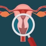 Endometriosis and Infertility - Dr Shweta Mendiratta