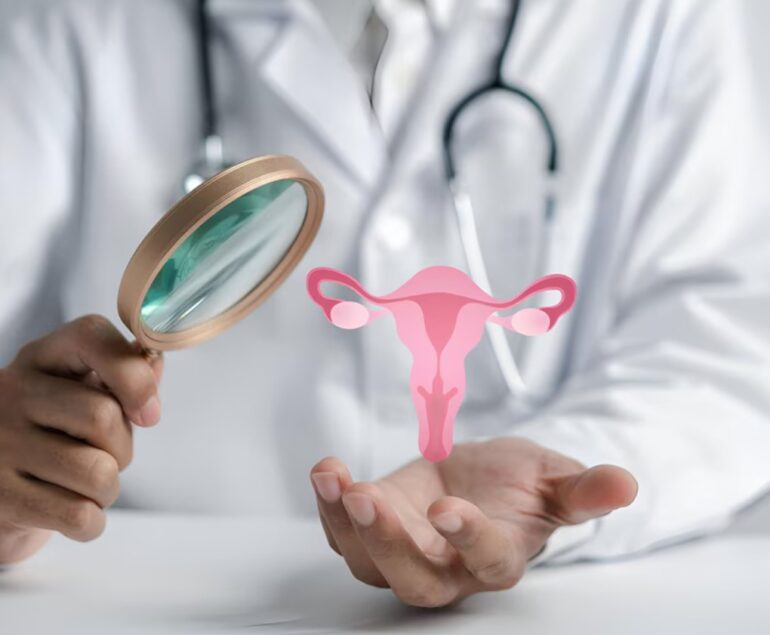 PCOS Awareness - Symptoms, Causes & Treatment in Faridabad