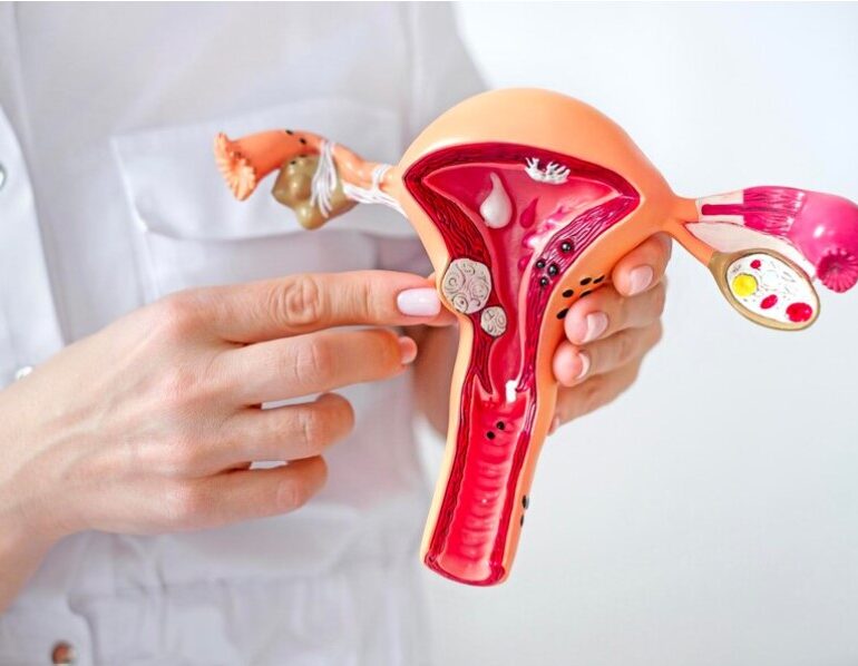 Early Diagnosis in Gynecological Cancers - Dr Shweta Mendiratta