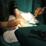 Laparoscopic vs Open Surgery – Dr Shweta Mendiratta