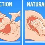 Normal Delivery or C-Section -Expert Guide by Dr Shweta Mendiratta