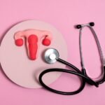 PCOS Treatment in Faridabad - Dr Shweta Mendiratta