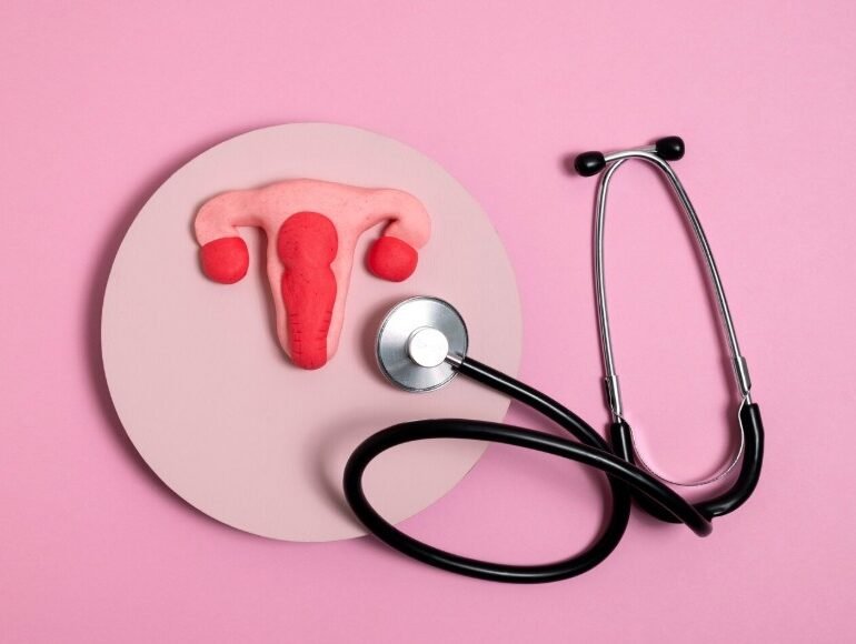 PCOS Treatment in Faridabad - Dr Shweta Mendiratta